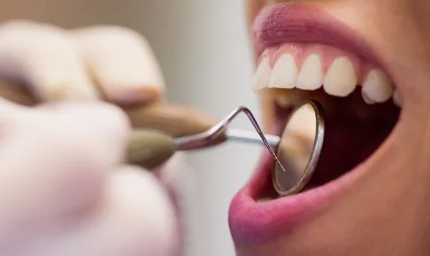 woman receiving a dental check up