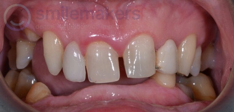 Combination 2 Before Compressed 768x368 2