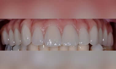 aftr2 8