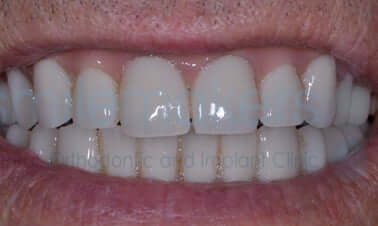 aftr3 9