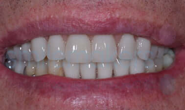 aftr8 1